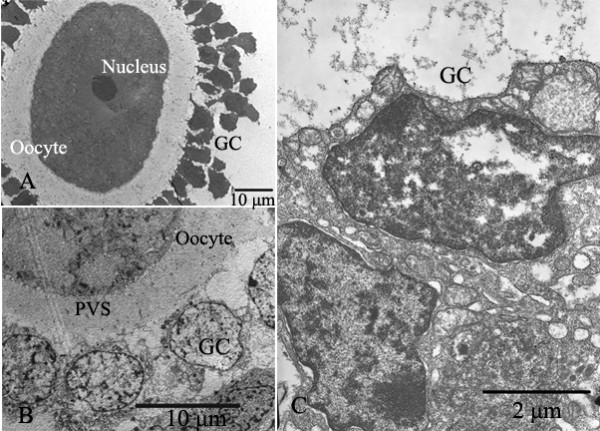 File:Electron micrographs of granulosa cells (GC).jpg