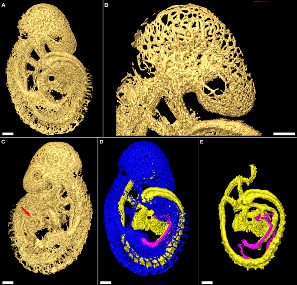 Mouse embryo (19 somite) vascular distribution