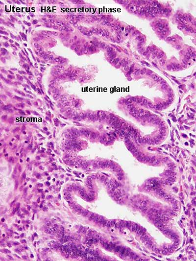 File:Uterine gland secretory phase.jpg