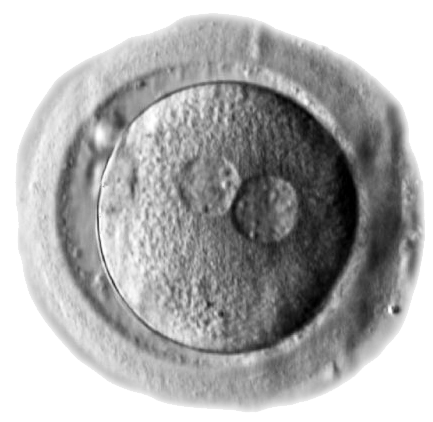 File:Human zygote two pronuclei 02.png - Embryology