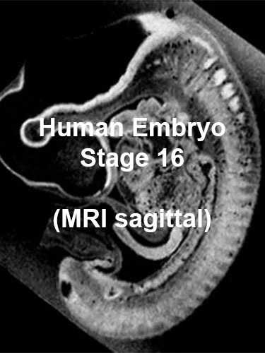 File:Stage16 MRI S01 icon.jpg