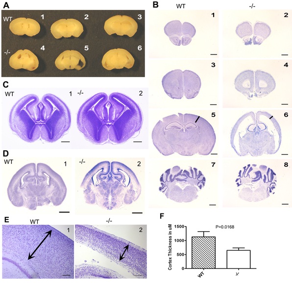 File:Absence of CSFR1 Impacts Normal Development of Brain Architecture.jpg
