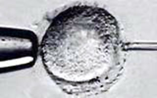 File:Intracytoplasmic sperm insemination.jpg