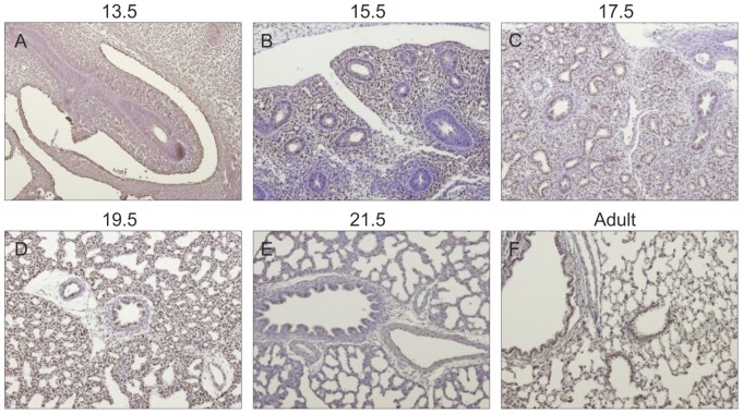 File:IL-11 expression pattern during fetal lung development.jpeg