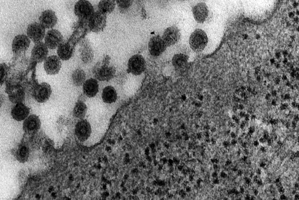 What Does Rubeola (Measles) Look Like? - Healthline