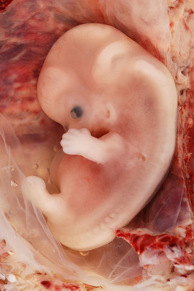 File:9 Week Human Embryo.jpg