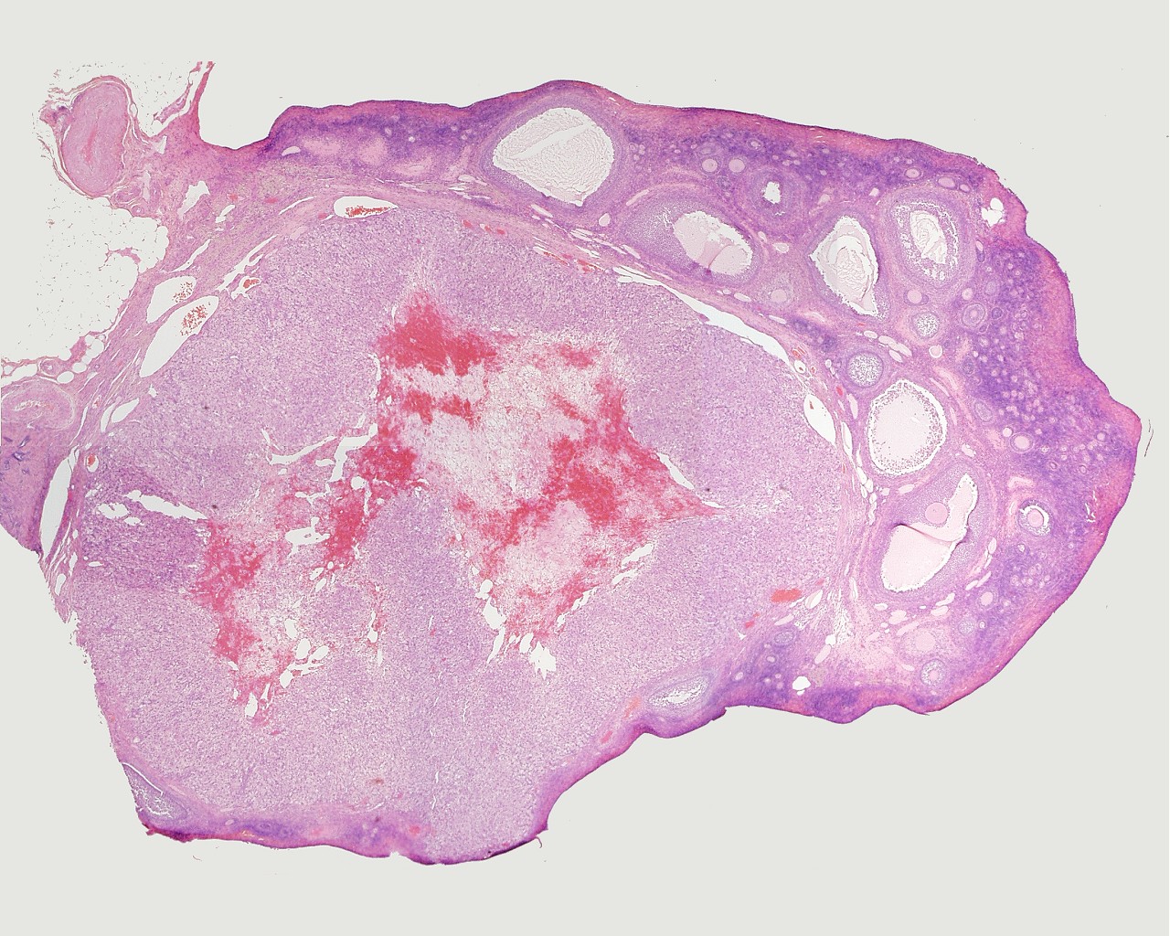 Histology Of The Ovary