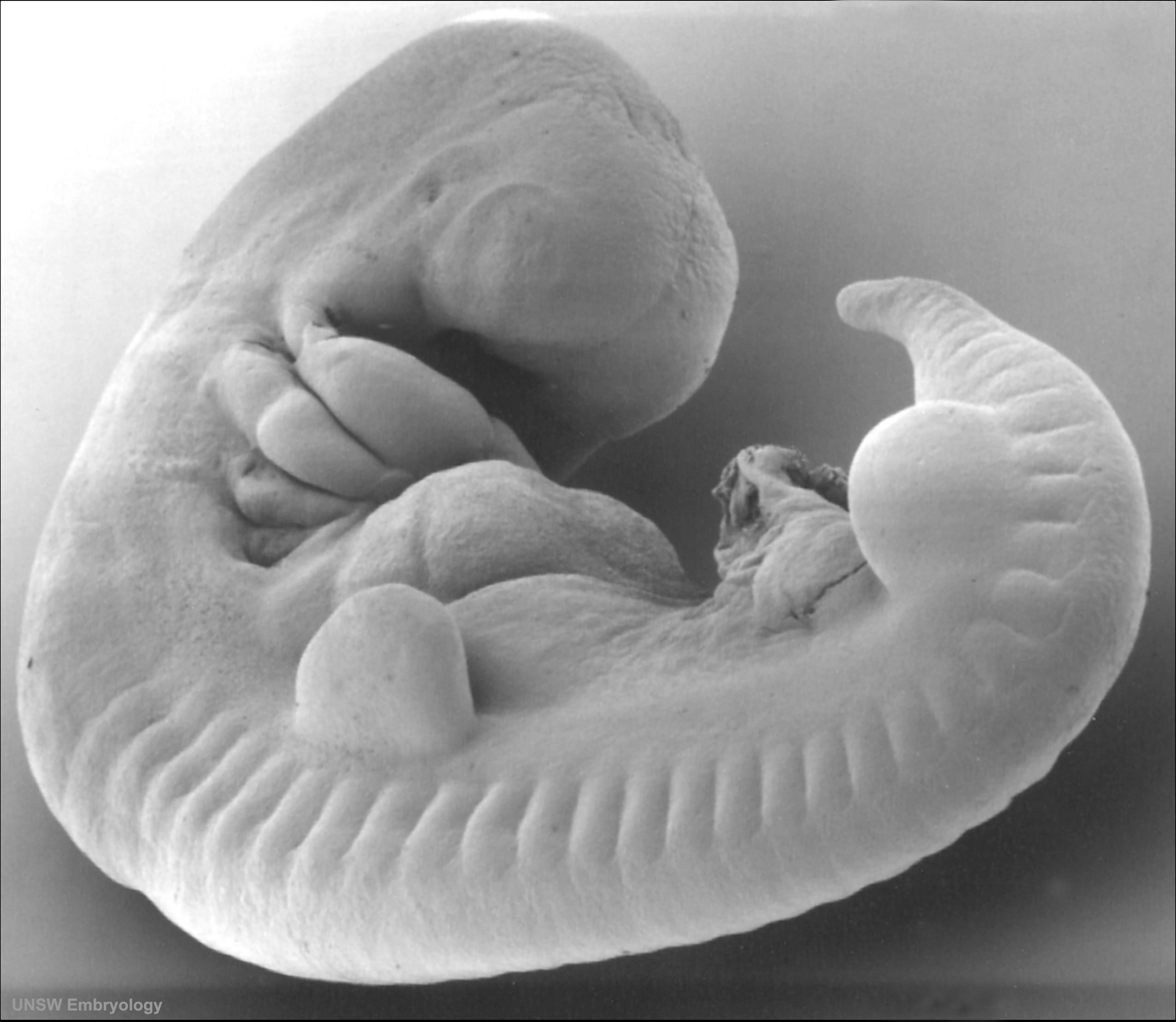 File:Stage14 sem5.jpg - Embryology