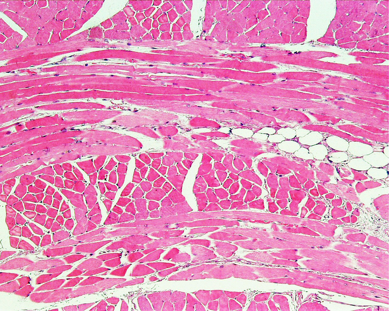 Skeletal Muscle 400x Magnification Skeletal Muscle 400x Magnification