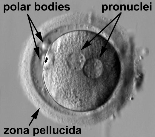 File:Human zygote two pronuclei 22.jpg