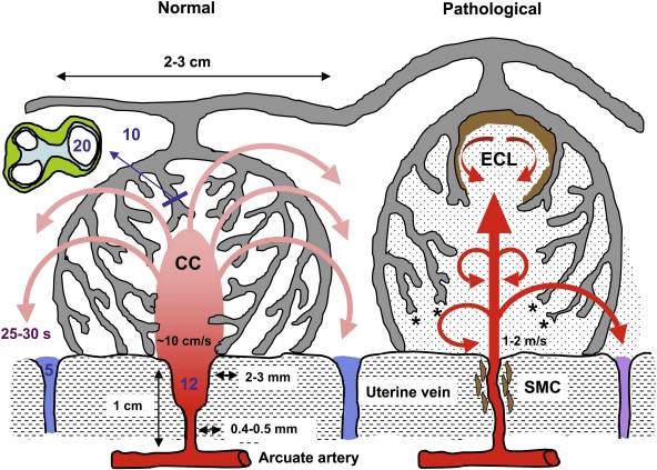 Placenta spiral artery conversion.jpg