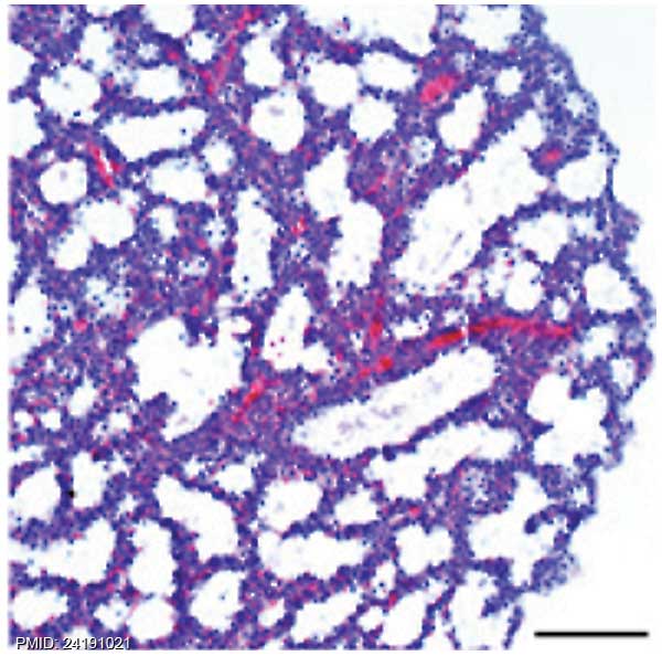 File:Mouse lung histology E18.5.jpg