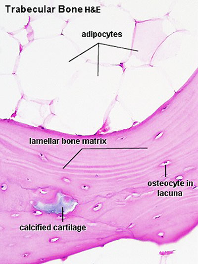 File:Bone histology 112.jpg