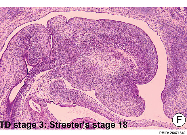 File:Human embryonic tongue 08.jpg