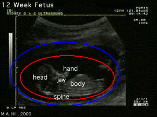 File:Ultrasound 12 week icon.jpg