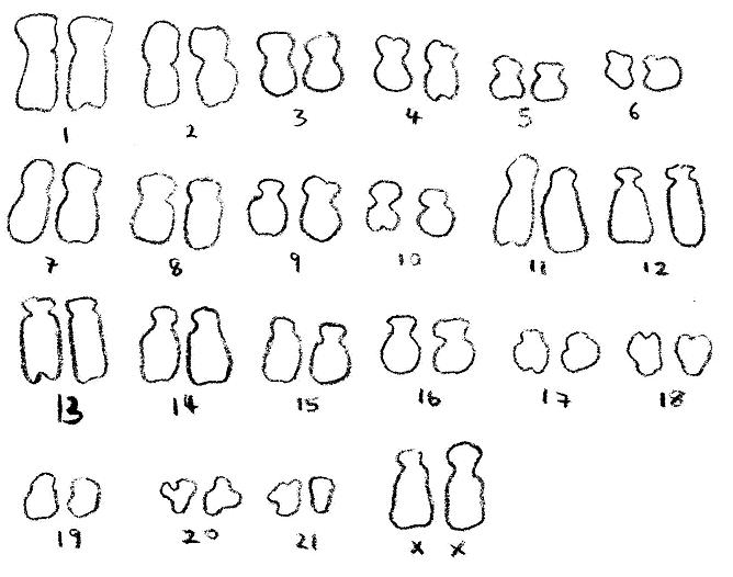 File:Drawn chromosome.jpg