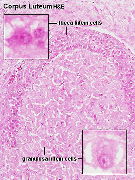 File:Corpus luteum lutein cells.jpg