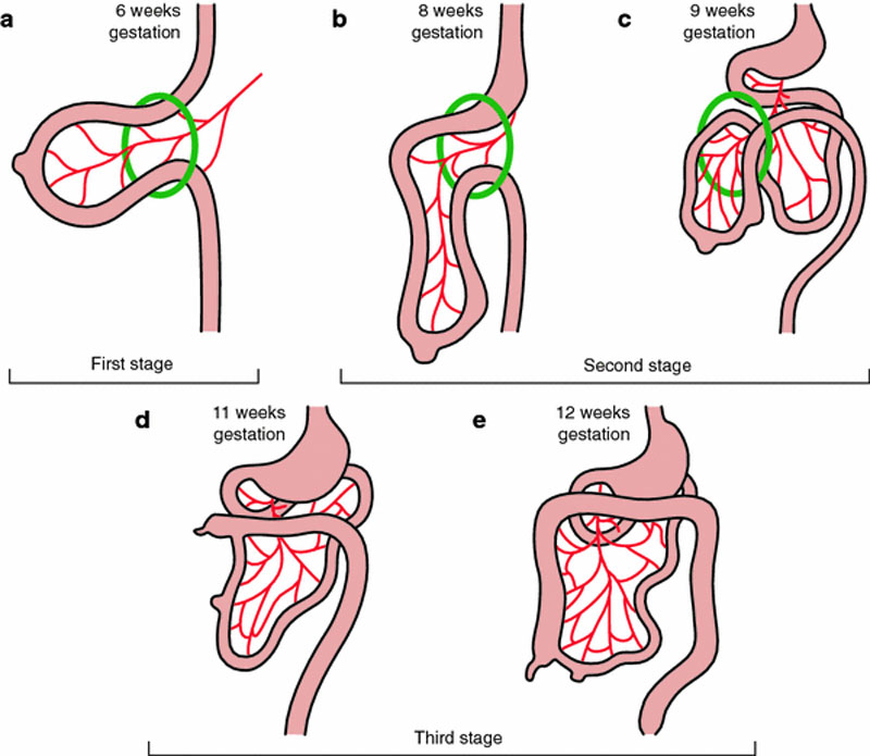 File Normal Intestinal Rotation Cartoon Embryology