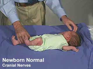 File:Newborn-cranial-nerves.jpg