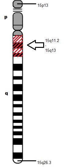 File:Chromosome 15 Deletion of 15q11.2 to 15q13.jpg