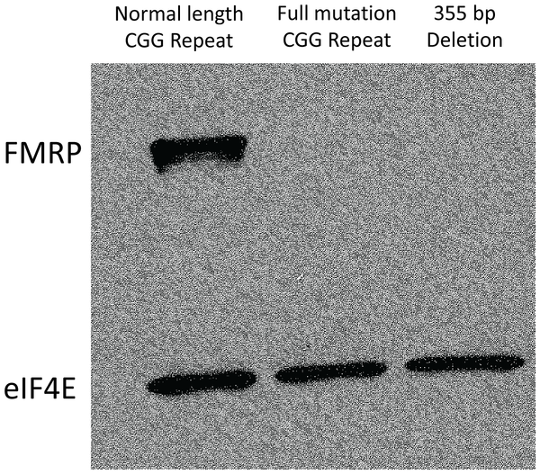 File:FMRP expression in control and fragile X tissues.png