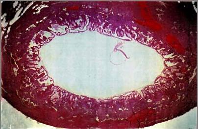 File:Human embryo 16-18 days 01.jpg