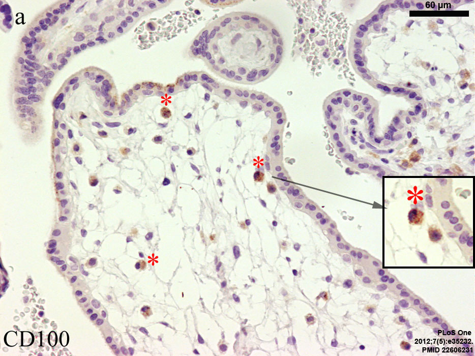 Placental villi Hofbauer cells[1]