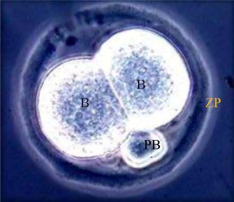 File:Normal Human 2-cell Embryo.jpeg