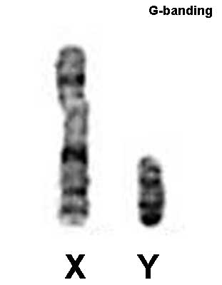 File:Male XY karyotype.jpg
