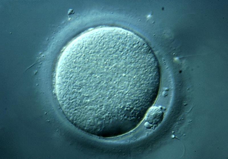 File:Secondary Oocyte during in-vitro fertilisation.jpeg