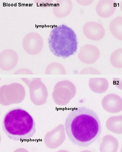 Lymphocyte 01.jpg