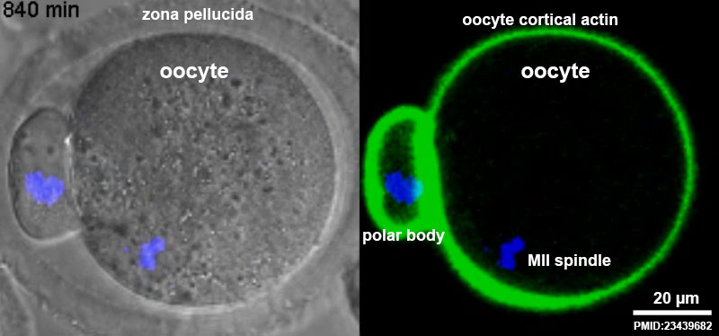 File:Oocyte meiosis movie 01 frame 5.jpg
