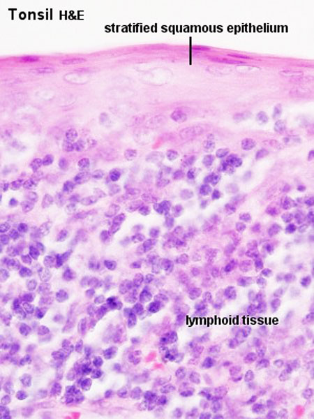 File:Tonsil histology 02.jpg