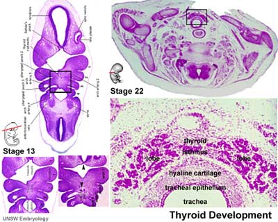 File:Stage13 and 22 thyroid development c.jpg