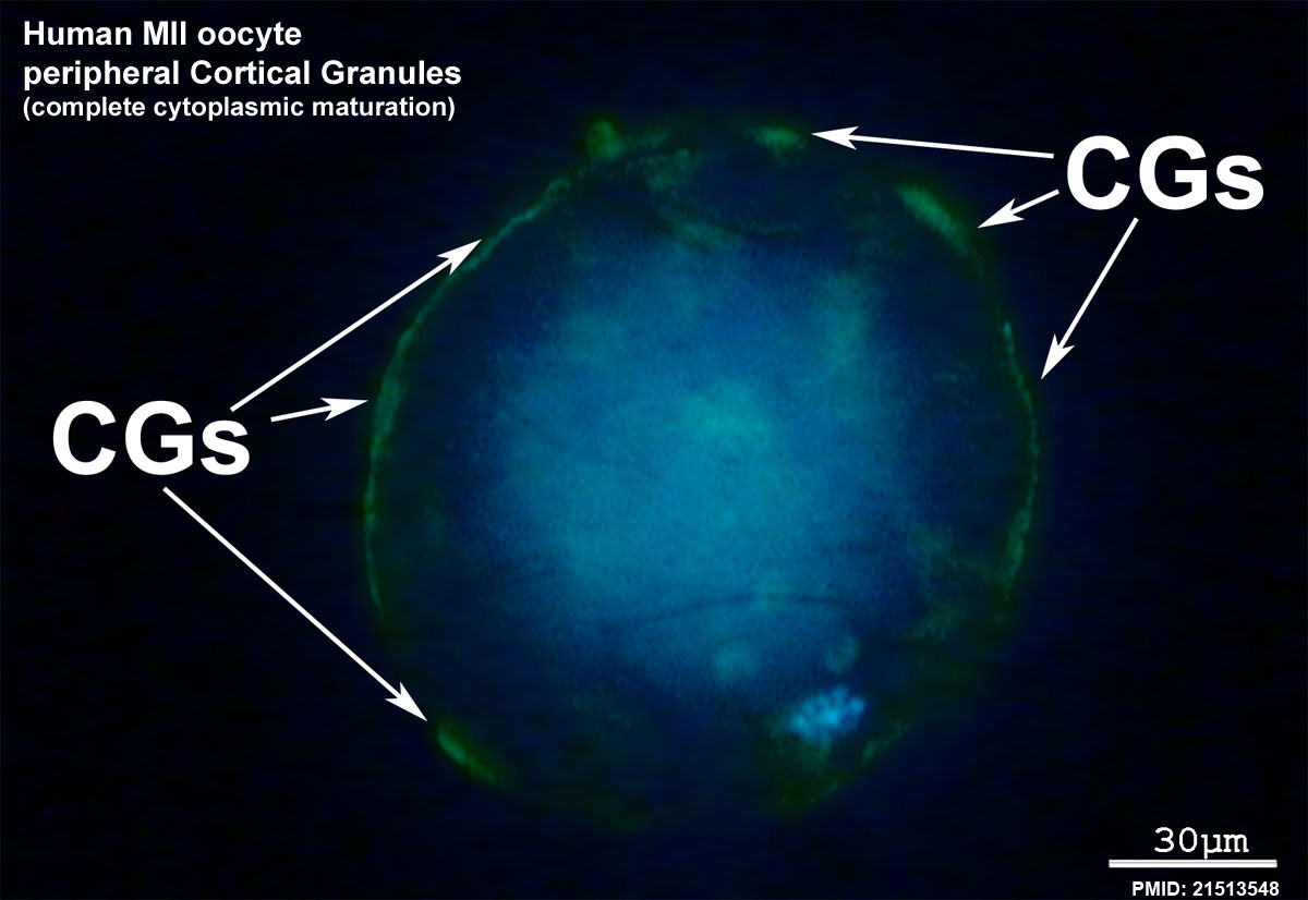 Human oocyte (MII) showing cortical granules (green)