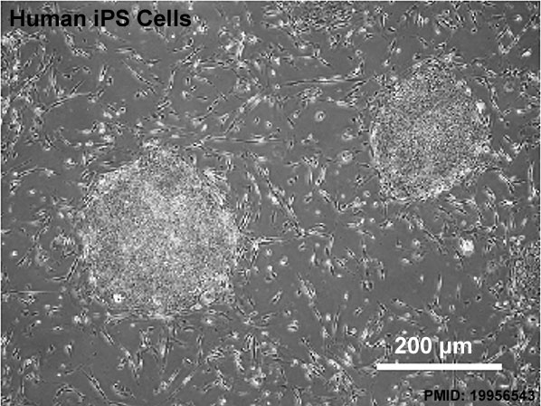 File:Human iPS cells 01.jpg