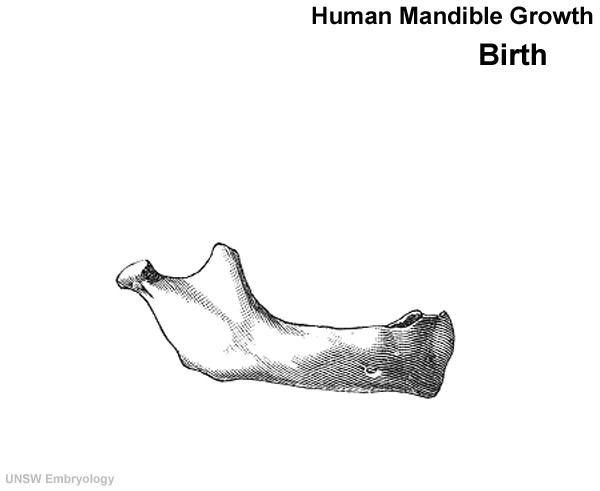 File:Postnatal human mandible growth.gif