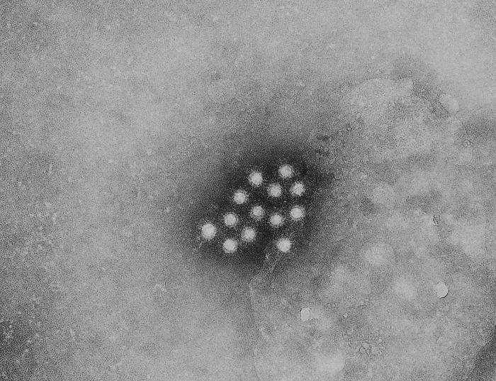 File:Hepatitis A virus.jpg