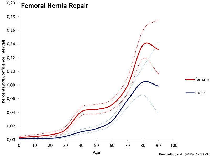 File:Femoral hernia repair.jpg