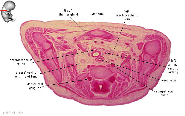 File:Embryo stage 22 C7L.jpg