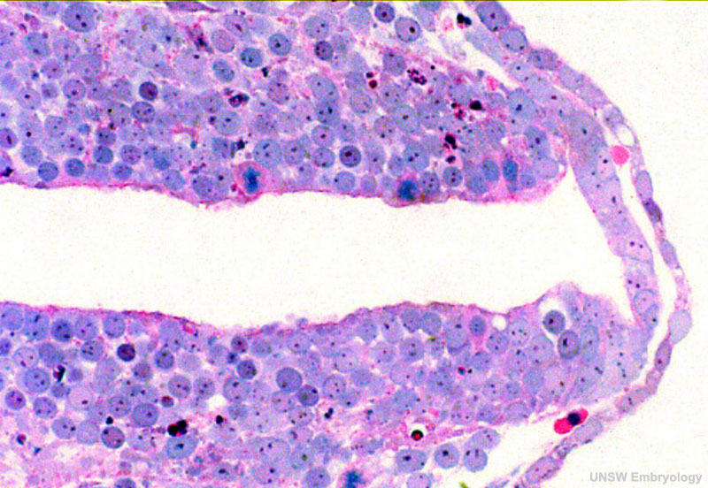 File:Stage11 histology-neural tube roof plate 2.jpg