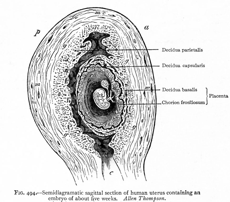 Historic - Semi-diagramatic sagittal section of human uterus containing an embryo of about five weeks