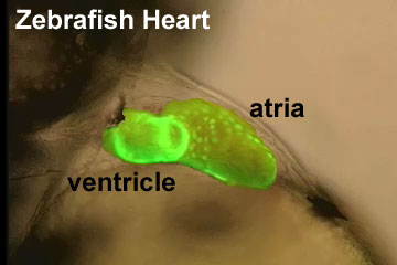 File:Zebrafish-heart-01.jpg