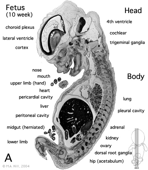 File:Human- fetal week 10 sagittal plane A.jpg