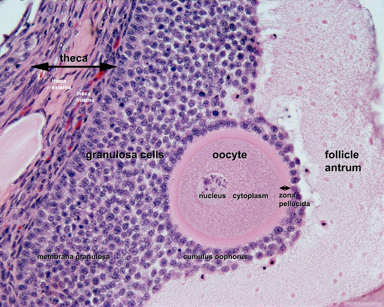 File:Ovary histology 061.jpg - Embryology