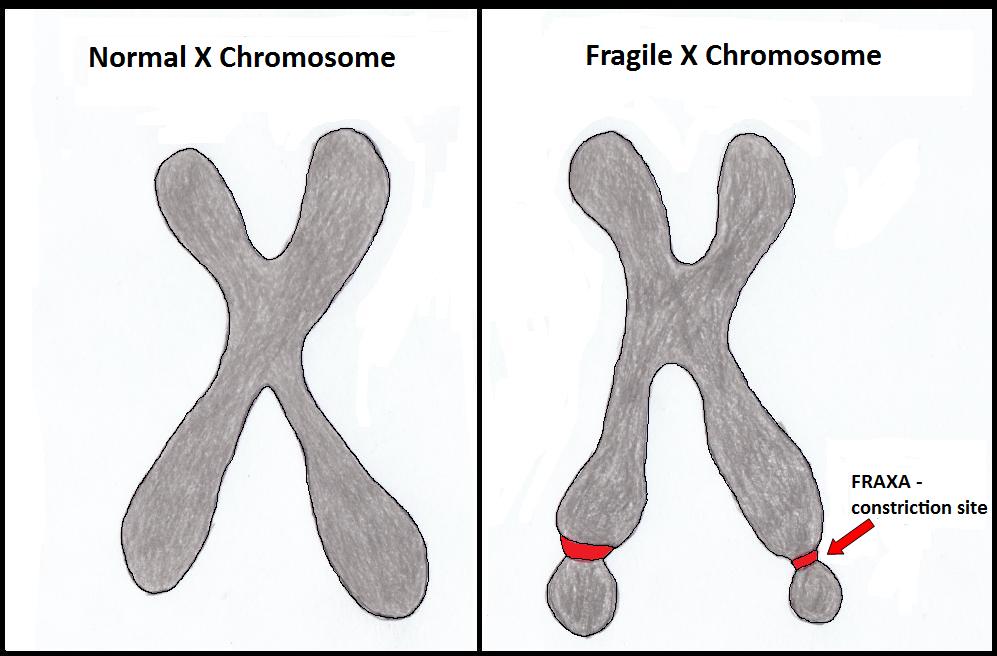 X-Chromosome [1999– ]