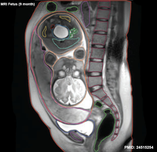 File:Fetal 9 month MRI 04.jpg