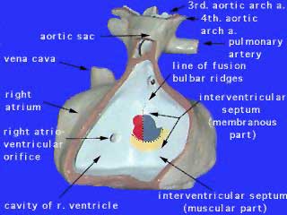 Heart-ventricular-septum-03.jpg