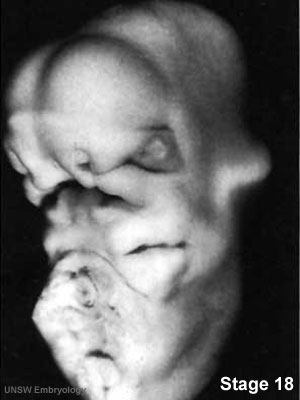 File:Human embryo head stage18.jpg