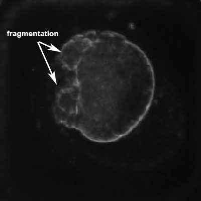 File:Monosomic embryo 2.jpg